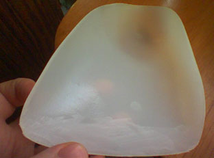 the concave inner surface of the orthotics